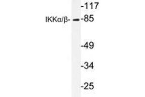 Western blot analysis of IKKα/β antibody in extracts from Jurkat cells. (IKK alpha 抗体)