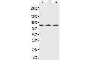 Anti-Ku80 antibody,  Western blotting Lane 1: U87 Cell Lysate Lane 2: A549 Cell Lysate Lane 3: MCF-7 Cell Lysate (XRCC5 抗体  (C-Term))