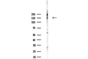 Western blot analysis of lysates from HepG2 cells(heat-shock,45 min treatment), using PCDH-X/Y Antibody at 1/1000 dilution. (PCDH-X/Y 抗体)
