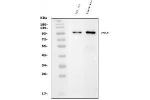 Western blot analysis of PDE6 beta/PDE6B using anti-PDE6 beta/PDE6B antibody (ABIN7600892).