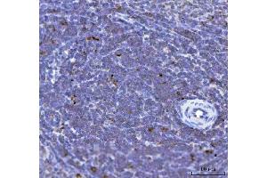 IHC analysis of TFEB using anti-TFEB antibody (ABIN7600648). (TFEB 抗体  (AA 214-326))