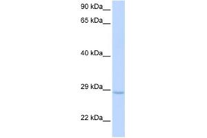 WB Suggested Anti-XRCC2 Antibody Titration: 0. (XRCC2 抗体  (Middle Region))