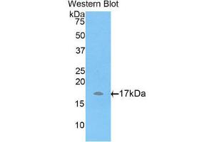 Western Blotting (WB) image for anti-ADAM Metallopeptidase with Thrombospondin Type 1 Motif, 7 (ADAMTS7) (AA 444-575) antibody (ABIN1857906)