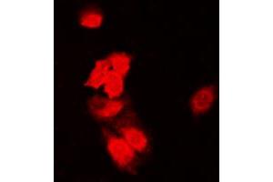Immunofluorescent analysis of SIAH1/2 staining in HeLa cells. (SIAH1/2 抗体  (Center))