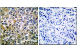 Immunohistochemistry (IHC) image for anti-SMAD, Mothers Against DPP Homolog 1 (SMAD1) (Ser465) antibody (ABIN1847896)