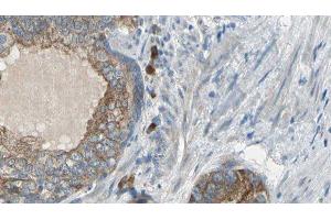 ABIN6275626 at 1/100 staining Human prostate tissue by IHC-P. (CCT6A 抗体  (Internal Region))