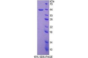 SDS-PAGE of Protein Standard from the Kit (Highly purified E. (SFTPD ELISA 试剂盒)