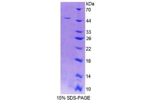 SDS-PAGE analysis of Human RFK Protein. (Riboflavin Kinase Protein (RFK))