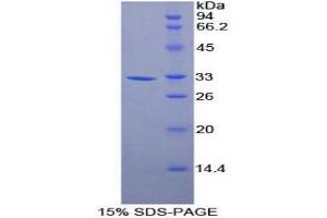 SDS-PAGE analysis of Mouse Annexin A6 Protein. (ANXA6 蛋白)