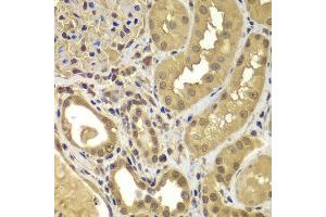 Immunohistochemistry of paraffin-embedded human kidney using SORT1 antibody at dilution of 1:100 (40x lens). (Sortilin 1 抗体)