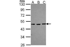 WB Image Sample (30 ug of whole cell lysate) A: A431 , B: JurKat C: Raji 10% SDS PAGE antibody diluted at 1:1000