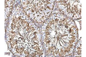 IHC-P Image alpha Tubulin 1A antibody detects alpha Tubulin 1A protein at cytosol on mouse testis by immunohistochemical analysis. (TUBA1A 抗体)
