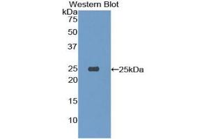 Detection of Recombinant TREM1, Mouse using Polyclonal Antibody to Triggering Receptor Expressed On Myeloid Cells 1 (TREM1) (TREM1 抗体  (AA 21-230))
