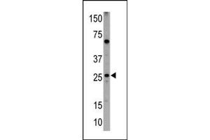 Image no. 1 for anti-BCL2/adenovirus E1B 19kDa Interacting Protein 3 (BNIP3) (BH3 Domain) antibody (ABIN356828) (BNIP3 抗体  (BH3 Domain))