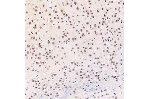 Immunohistochemistry analysis of paraffin-embedded mouse brain using,GTF2F2 (ABIN7074036) at dilution of 1: 3000 (GTF2F2 抗体)