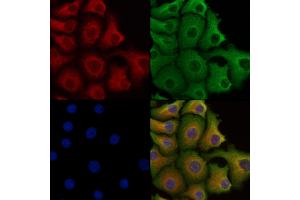 ABIN6258003 and ABIN6273451 staining Hela cells by IF/ICC.
