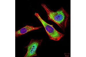 Immunofluorescence analysis of Hela cells using ATG5 mouse mAb (green). (ATG5 抗体)