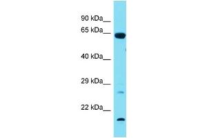 Host:  Rabbit  Target Name:  Tbx18  Sample Type:  Rat Lung lysates  Antibody Dilution:  1.
