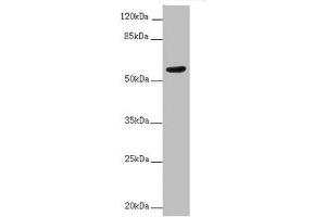Western blot All lanes: ACVRL1 antibody at 2 μg/mL + MCF-7 whole cell lysate Secondary Goat polyclonal to rabbit IgG at 1/10000 dilution Predicted band size: 57 kDa Observed band size: 57 kDa (ACVRL1 抗体  (AA 22-118))