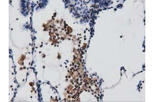 Immunohistochemistry (IHC) image for anti-rho GTPase Activating Protein 25 (ARHGAP25) antibody (ABIN1496706) (ARHGAP25 抗体)