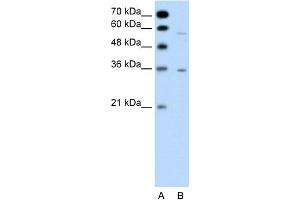 WB Suggested Anti-GPCR5A Antibody Titration:  0. (GPRC5A 抗体  (C-Term))