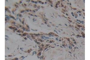 Immunohistochemistry (IHC) image for anti-Angiotensin I Converting Enzyme (Peptidyl-Dipeptidase A) 1 (ACE) (AA 1160-1306) antibody (ABIN7442498)