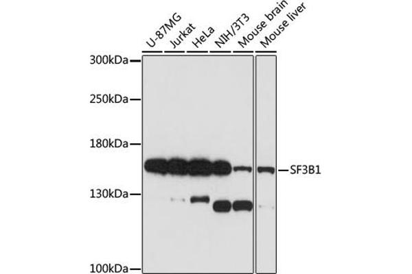 SF3B1 抗体  (AA 1-144)