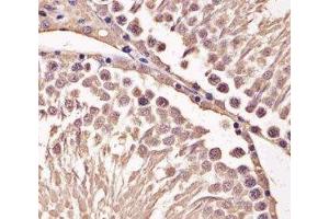 IHC analysis of FFPE mouse testis section using Cyclin B1 antibody; Ab was diluted at 1:25. (Cyclin B1 抗体  (AA 103-130))