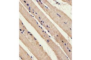 Immunohistochemical analysis of paraffin-embedded M. (LKB1 抗体  (C-Term))