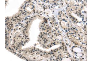 Immunohistochemistry (IHC) image for anti-Tumor Suppressor Candidate 5 (TUSC5) antibody (ABIN5960749)