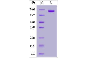 SDS-PAGE (SDS) image for Neural Cell Adhesion Molecule 1 (NCAM1) (AA 20-718) protein (His tag,FITC) (ABIN7013804)