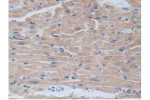 IHC-P analysis of Mouse Heart Tissue, with DAB staining. (BRD8 抗体  (AA 797-951))