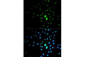 Immunofluorescence analysis of MCF7 cell using PIN1 antibody. (PIN1 抗体  (AA 1-163))