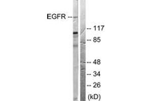 Western blot analysis of extracts from 293 cells, treated with EGF 200ng/ml 30', using EGFR (Ab-678) Antibody. (EGFR 抗体  (AA 651-700))