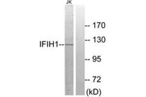 Western Blotting (WB) image for anti-Interferon Induced with Helicase C Domain 1 (IFIH1) (AA 976-1025) antibody (ABIN2889746) (IFIH1 抗体  (AA 976-1025))
