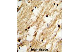 Formalin-fixed and paraffin-embedded human brain tissue with DCC1 Antibody (N-term), which was peroxidase-conjugated to the secondary antibody, followed by DAB staining. (DSCC1 抗体  (N-Term))