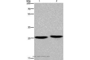 Western blot analysis of Mouse brain and human fetal muscle tissue, using EPDR1 Polyclonal Antibody at dilution of 1:850 (EPDR1 抗体)