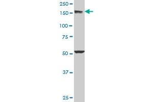 EEA1 monoclonal antibody (M03), clone 2G2. (EEA1 抗体  (AA 1312-1411))