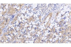 Detection of Slit3 in Porcine Stomach Tissue using Polyclonal Antibody to Slit Homolog 3 (Slit3) (SLIT3 抗体  (AA 1405-1512))
