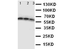 Anti-CD40 antibody, Western blotting Lane 1: Recombinant Human CD40 Protein 10ng Lane 2: Recombinant Human CD40 Protein 5ng Lane 3: Recombinant Human CD40 Protein 2. (CD40 抗体  (N-Term))