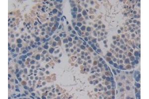 Immunohistochemistry (IHC) image for anti-Pyruvate Dehydrogenase Complex, Component X (PDHX) (AA 222-471) antibody (ABIN7443338)