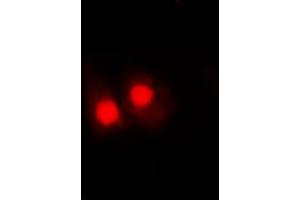 Immunofluorescent analysis of FANCA (pS1149) staining in HepG2 cells. (FANCA 抗体  (C-Term, pSer1149))