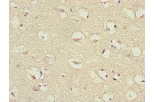 Immunohistochemistry of paraffin-embedded human brain tissue using ABIN7147409 at dilution of 1:100 (CEP57 抗体  (AA 1-240))