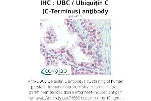 Image no. 1 for anti-Ubiquitin C (UBC) (C-Term) antibody (ABIN2852400) (UBC 抗体  (C-Term))