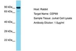 Image no. 1 for anti-Centrosomal Protein 89kDa (CEP89) (AA 41-90) antibody (ABIN6750706) (CEP89 抗体  (AA 41-90))