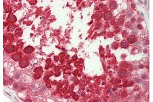 Rabbit Anti-Ubl5 antibody Catalog Number: ARP56285 Formalin Fixed Paraffin Embedded Tissue: Human Testis Primary antibody Concentration: 1:100 Secondary Antibody: Donkey anti-Rabbit-Cy3 Secondary Antibody Concentration: 1:200 Magnification: 20x Exposure Time: 0. (UBL5 抗体  (N-Term))