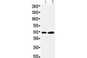 Anti-Selenium Binding Protein 1 antibody, Western blotting Lane 1: COLO320 Cell Lysate Lane 2: PANC Cell Lysate (SELENBP1 抗体  (Middle Region))