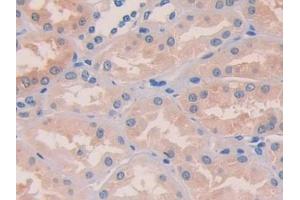 Immunohistochemistry (IHC) image for anti-Desert Hedgehog (DHH) (AA 241-383) antibody (ABIN7438166)