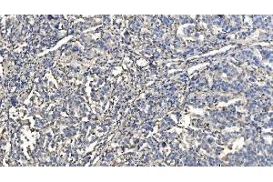 IHC analysis of HYI using anti-HYI antibody (ABIN7601796). (HYI 抗体  (AA 46-277))