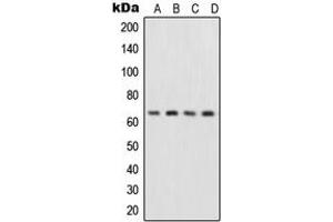 Western blot analysis of NF-kappaB p65 expression in HepG2 (A), MCF7 (B), Raw264. (NF-kB p65 抗体  (Center))